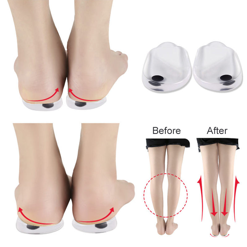 StepAlign™ | Shoe Insoles Correction Inserts Pads